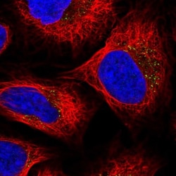 Cytosolic Sulfotransferase 2B1/SULT2B1 Antibody, Novus Biologicals 0.1mL;